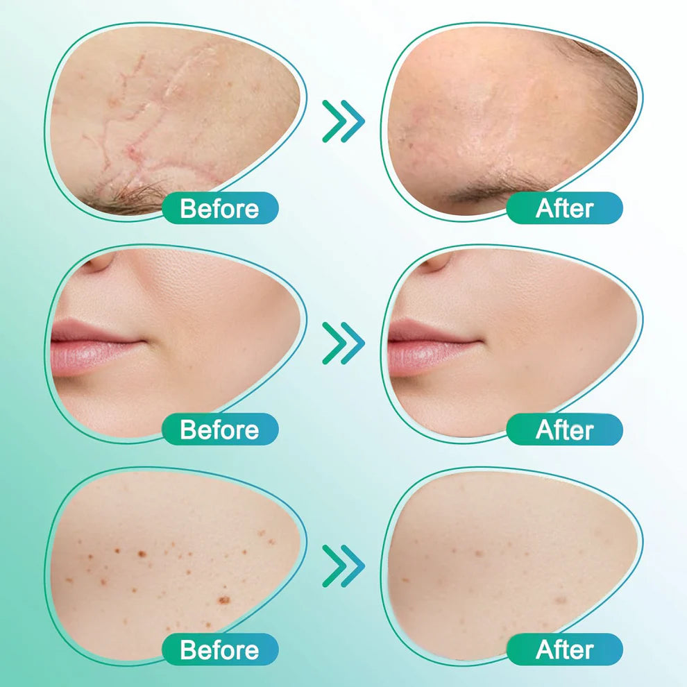 ๐๐ฎ๐ฟ๐ฒ๐๐ฟ๐ฒ๐ฒ๐๐ฒยฎ 3-in-1 Microneedle Care Patch