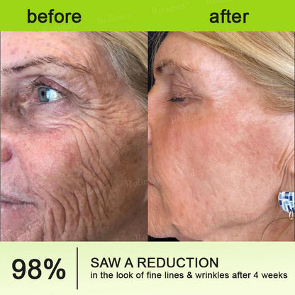 👨‍⚕️👨‍⚕️👨‍⚕️Made and shipped from the USA 💫Rolimey® Botox & Vita-A Retinol Shot Wrinkle-Lift Tightening cream - Last Day Promotion 50% OFF