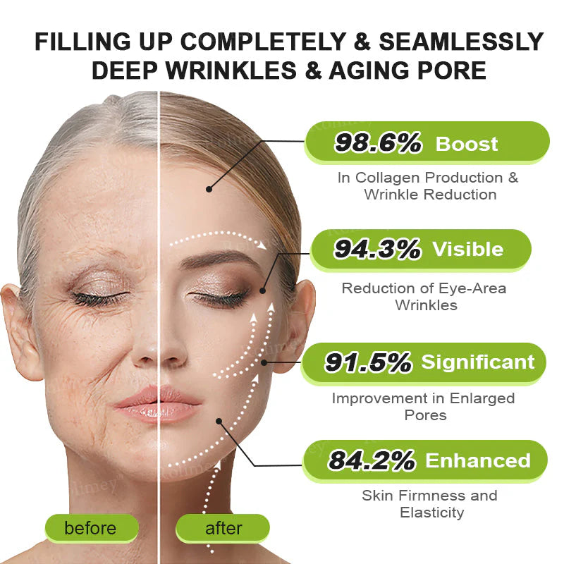 👨‍⚕️👨‍⚕️👨‍⚕️Made and shipped from the USA 💫Rolimey® Botox & Vita-A Retinol Shot Wrinkle-Lift Tightening cream - Last Day Promotion 50% OFF