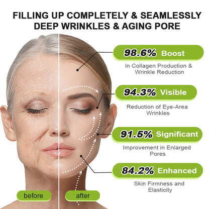 👨‍⚕️👨‍⚕️👨‍⚕️Made and shipped from the USA 💫Rolimey® Botox & Vita-A Retinol Shot Wrinkle-Lift Tightening cream - Last Day Promotion 50% OFF