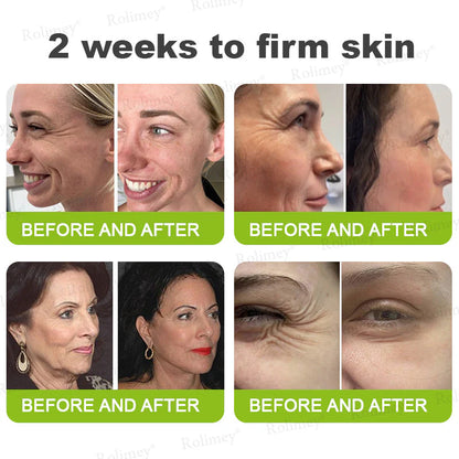 👨‍⚕️👨‍⚕️👨‍⚕️Made and shipped from the USA 💫Rolimey® Botox & Vita-A Retinol Shot Wrinkle-Lift Tightening cream - Last Day Promotion 50% OFF