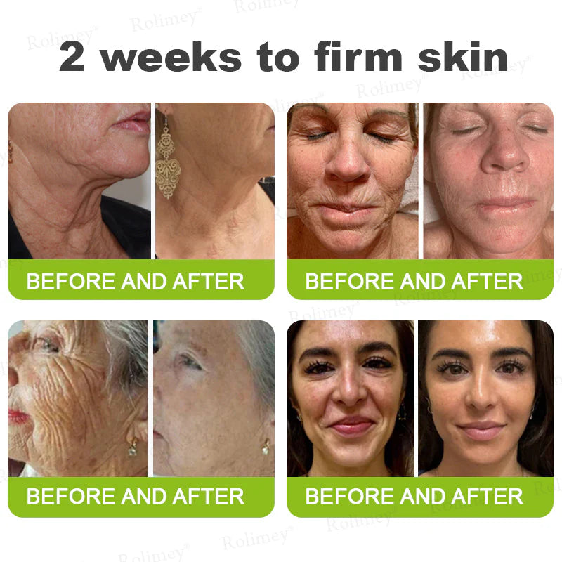 👨‍⚕️👨‍⚕️👨‍⚕️Made and shipped from the USA 💫Rolimey® Botox & Vita-A Retinol Shot Wrinkle-Lift Tightening cream - Last Day Promotion 50% OFF