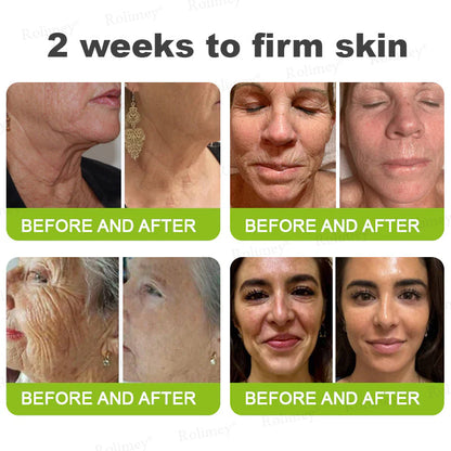 👨‍⚕️👨‍⚕️👨‍⚕️Made and shipped from the USA 💫Rolimey® Botox & Vita-A Retinol Shot Wrinkle-Lift Tightening cream - Last Day Promotion 50% OFF