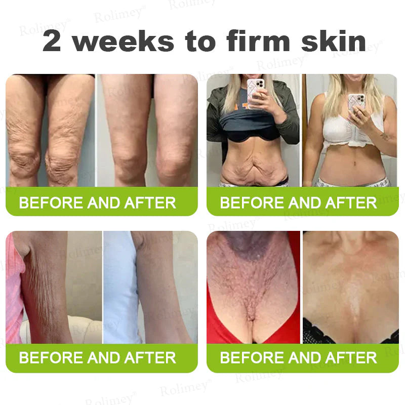 👨‍⚕️👨‍⚕️👨‍⚕️Made and shipped from the USA 💫Rolimey® Botox & Vita-A Retinol Shot Wrinkle-Lift Tightening cream - Last Day Promotion 50% OFF