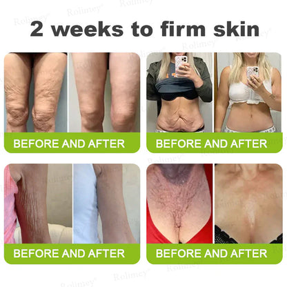 👨‍⚕️👨‍⚕️👨‍⚕️Made and shipped from the USA 💫Rolimey® Botox & Vita-A Retinol Shot Wrinkle-Lift Tightening cream - Last Day Promotion 50% OFF